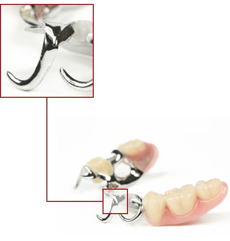 Dental Workings Dental Workings
